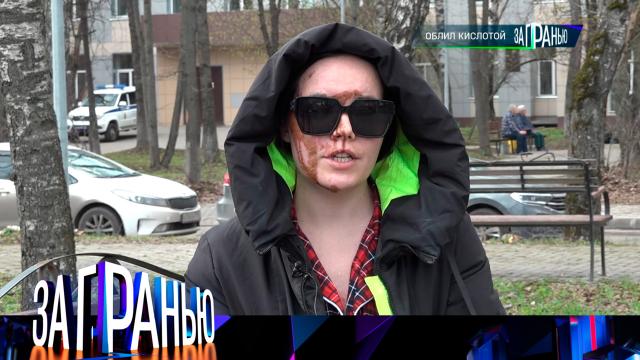 «Облил кислотой»